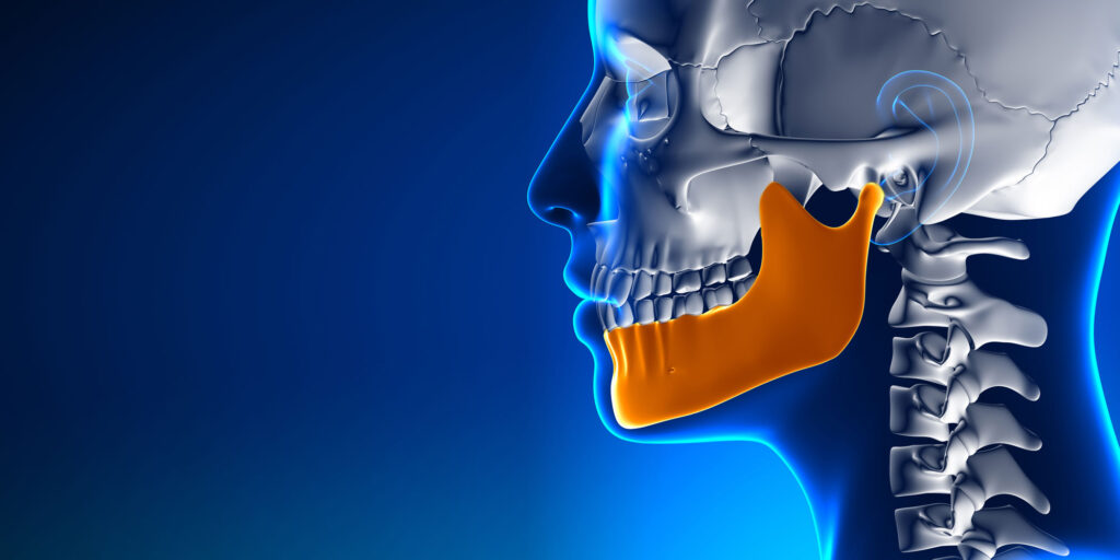 jaw bone of person with tmj