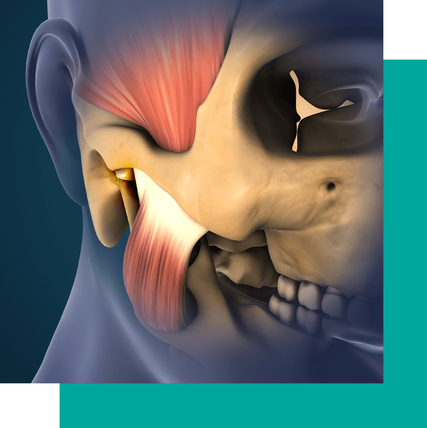 3d tmj model