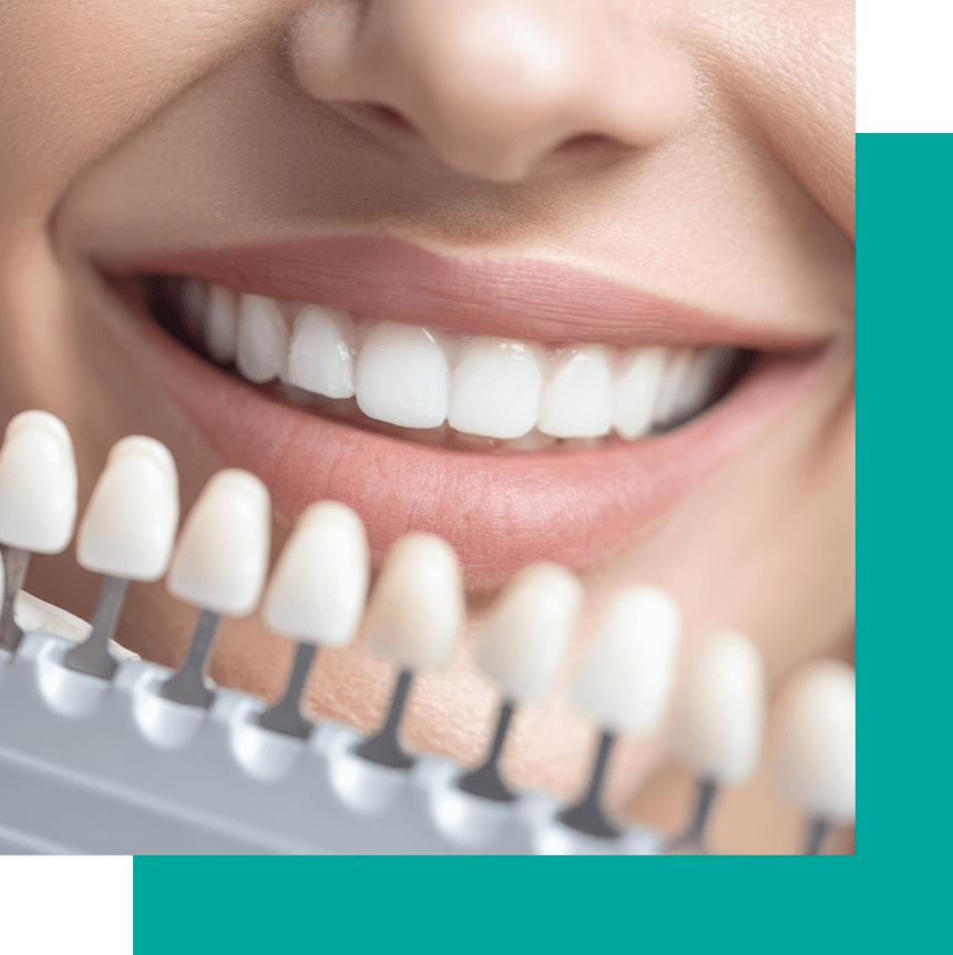 patient trying veneers