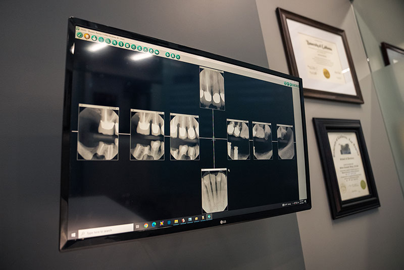x ray